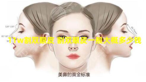 11w割双眼皮 割双眼皮一般大概多少钱